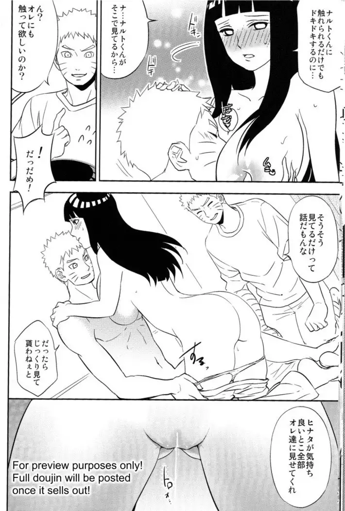 Naruto-kun ni onegai sa retara kotowarenai