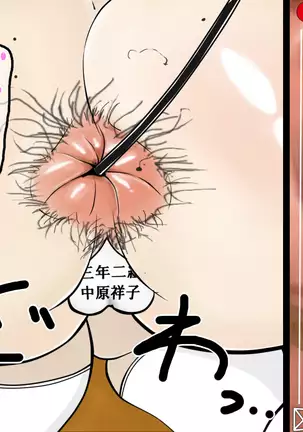 Schoolgirl open endoscopy